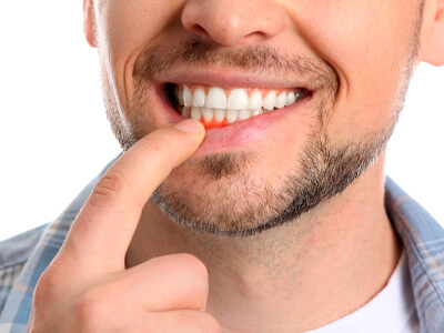 Periodontia - Centro - Paracambi - RJ